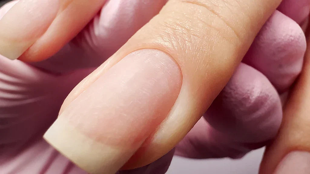 Cutilagem, cuticulagem ou cutilação?